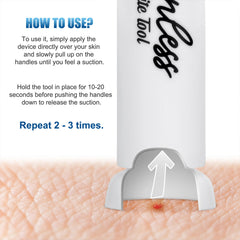 Itch Relief Suction Tool Bug Bite Thing Suction Tool Bug Bites and Bee Wasp Stings Natural Insect Bite Relief Chemical Free